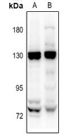 Rabbit Polyclonal Antibody to ADGRE1