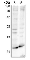 Rabbit Polyclonal Antibody to RRH