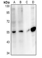 Rabbit Polyclonal Antibody to SLC10A4