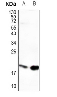 Rabbit Polyclonal Antibody to PDE6G