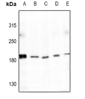 Rabbit Polyclonal Antibody to COL4A4