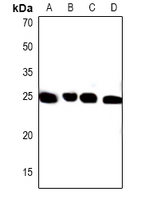 Rabbit Polyclonal Antibody to PXMP4