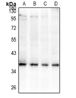 Rabbit Polyclonal Antibody to GPR42