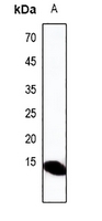Rabbit Polyclonal Antibody to DEFA3