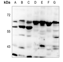 Rabbit Polyclonal Antibody to MCOLN3