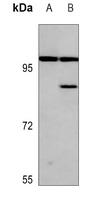 Rabbit Polyclonal Antibody to AKAP2
