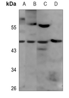Rabbit Polyclonal Antibody to NKX6-1