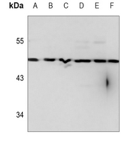 Rabbit Polyclonal Antibody to RFPL1