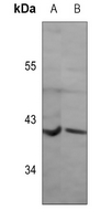 Rabbit Polyclonal Antibody to OPN5