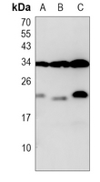 Rabbit Polyclonal Antibody to JTB