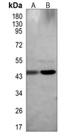 Rabbit Polyclonal Antibody to TSSK1B