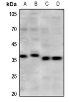 Rabbit Polyclonal Antibody to PAQR5
