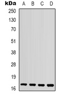 Rabbit Polyclonal Antibody to IL1F10