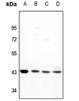 Rabbit Polyclonal Antibody to OXER1