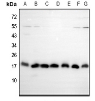 Rabbit Polyclonal Antibody to EIF5A2