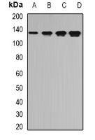 Rabbit Polyclonal Antibody to TPP2