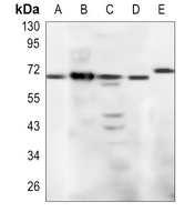 Rabbit Polyclonal Antibody to KLRD1