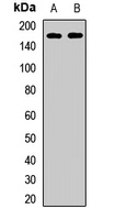 Rabbit Polyclonal Antibody to KTN1