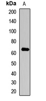 Rabbit Polyclonal Antibody to COL10A1