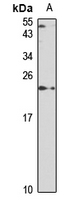 Rabbit Polyclonal Antibody to SAT1