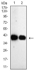 Mouse Monoclonal Antibody to AKR1C1