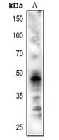 Rabbit Polyclonal Antibody to CRD1
