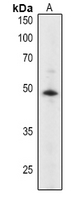 Rabbit Polyclonal Antibody to ABI2