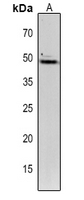 Rabbit Polyclonal Antibody to TIC40