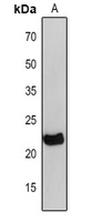 Rabbit Polyclonal Antibody to petC