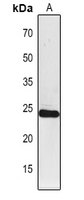 Rabbit Polyclonal Antibody to PSAF