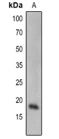 Rabbit Polyclonal Antibody to SCE1
