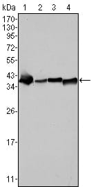 Mouse Monoclonal Antibody to Nucleophosmin