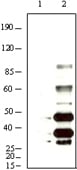 Mouse Monoclonal Antibody to KSHV K8a