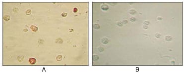 Mouse Monoclonal Antibody to KSHV ORF45
