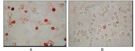 Mouse Monoclonal Antibody to KSHV ORF62