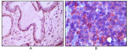 Mouse Monoclonal Antibody to CD10