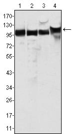 Mouse Monoclonal Antibody to MSH2