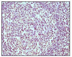 Mouse Monoclonal Antibody to CD19