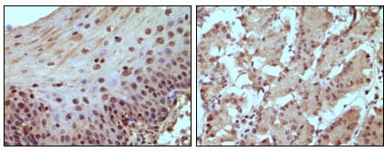 Mouse Monoclonal Antibody to RB