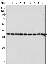 Mouse Monoclonal Antibody to GAPDH