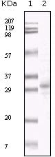 Mouse Monoclonal Antibody to KSHV ORF26