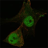 Mouse Monoclonal Antibody to Foxp3