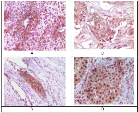 Mouse Monoclonal Antibody to Rab25