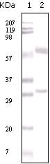 Mouse Monoclonal Antibody to ER-alpha
