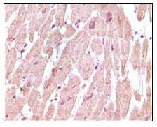 Mouse Monoclonal Antibody to cTnI