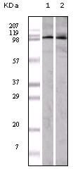 Mouse Monoclonal Antibody to EphA1