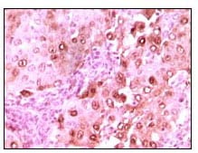 Mouse Monoclonal Antibody to S100A6