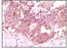 Mouse Monoclonal Antibody to FGF2