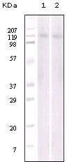 Mouse Monoclonal Antibody to EphB6