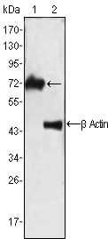 Mouse Monoclonal Antibody to ZAP70